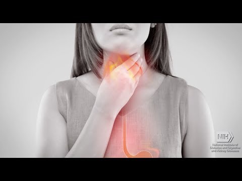 Video: Burning Throat: 9 Možných Príčin A Nápravných Opatrení, Ktoré Môžete Vyskúšať