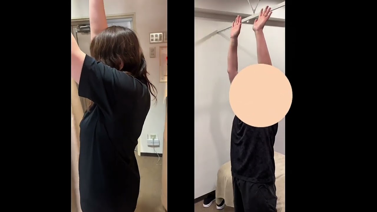 40代女性 肩を上げる動きのビフォーアフター