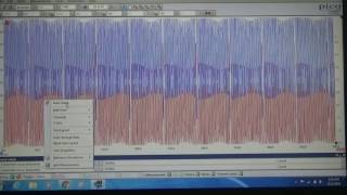 PicoScope Guided Tests - Inductive Camshaft Sensor - from Saelig