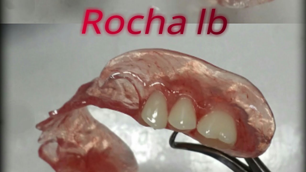 Incluindo uma prótese flexível