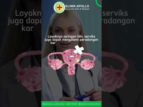 Video: Antibiotiklər servisitə kömək edirmi?