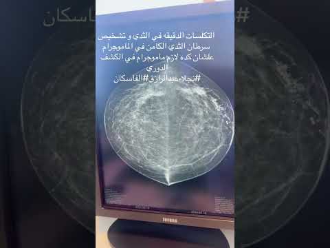 ليه لازم الماموجرام و السونار لوحده مش كفاية