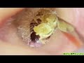 ASMR：一発でスーッ！脳が解放される音はこれ！