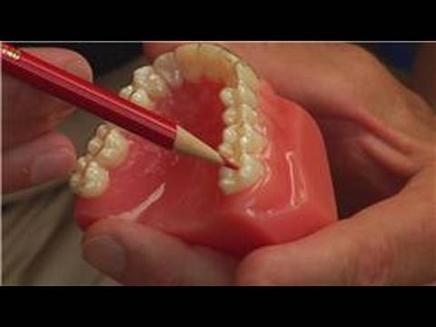 Tooth & Gum Abscesses : How Dentists Drain an Abscessed Tooth