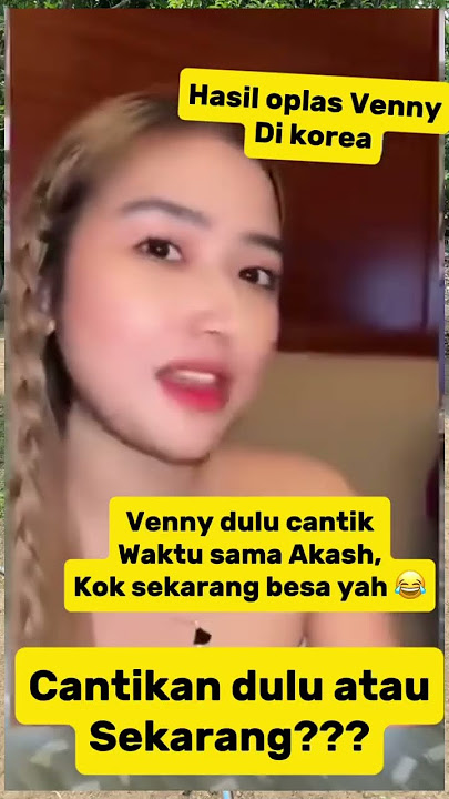 Ternyata bukannya tambah cantik, Venny Alberti malah begini! #vennyalberti #viralvideo #trending
