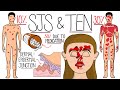 Understanding stevensjohnson syndrome and toxic epidermal necrolysis sjs  ten