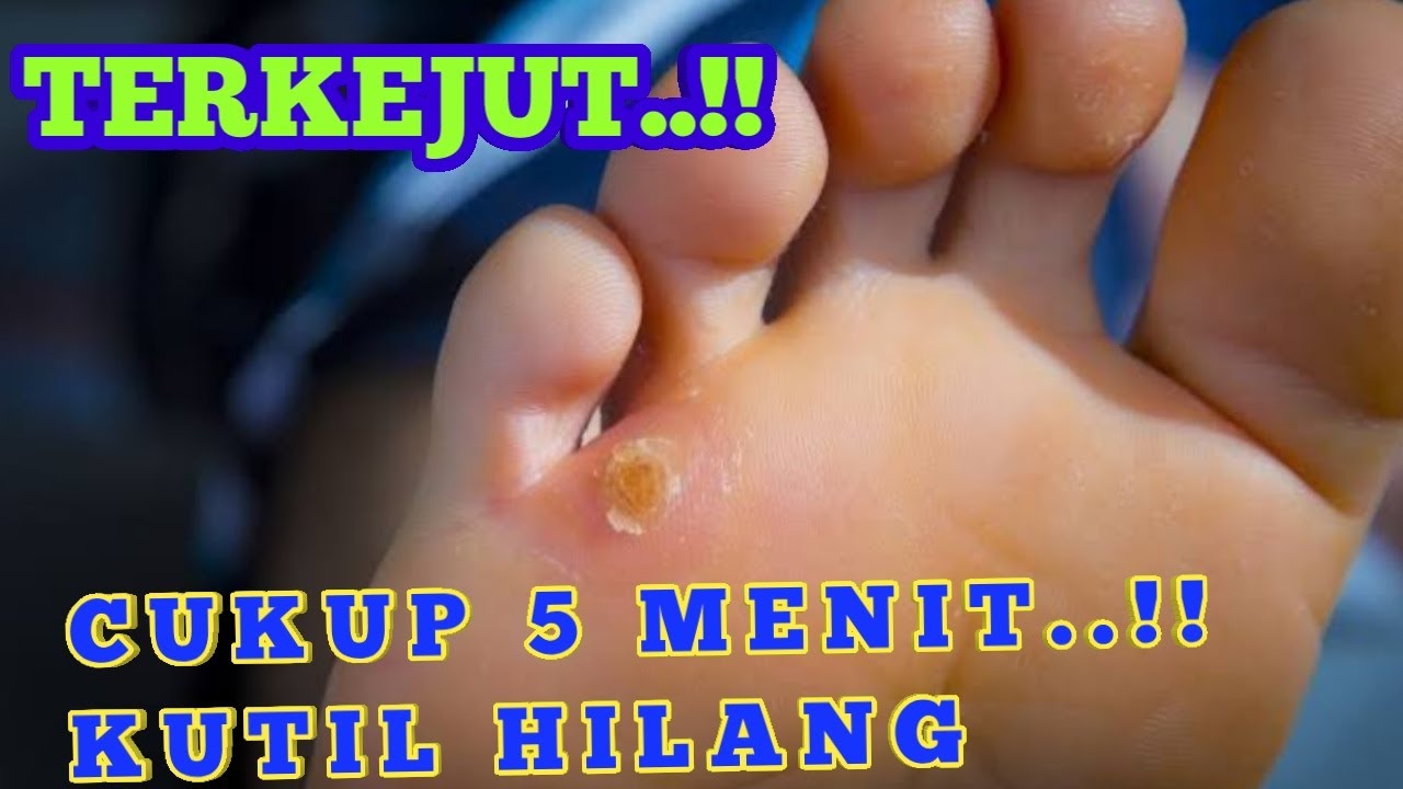 MUJARABBB...!! Cara Mengobati Mata Ikan, Cukup Dengan Bahan alami