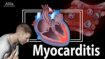 Myocarditis: Causes, Pathophysiology, Symptoms, Diagnosis and Treatment.