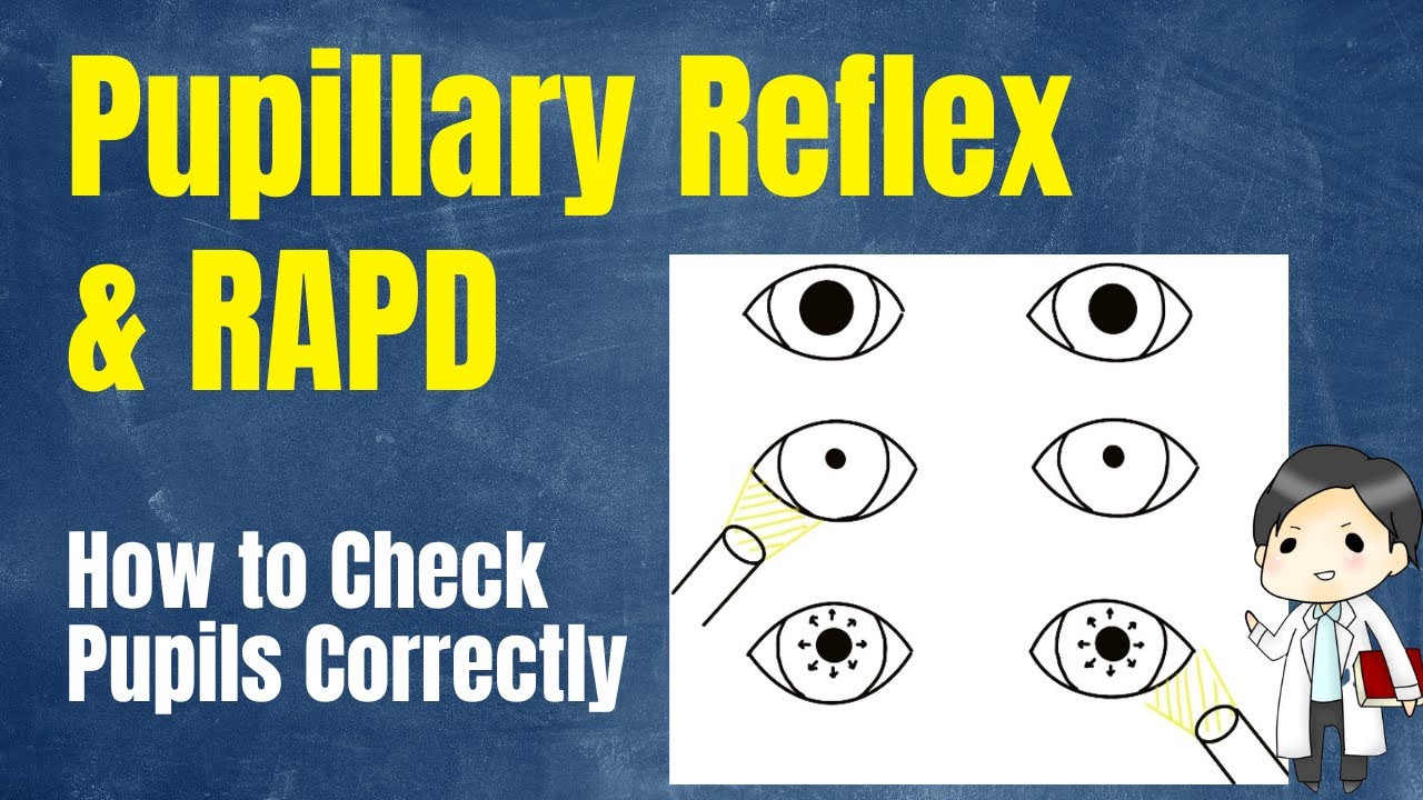 How to Check Pupils Correctly | Pupillary Reflex & RAPD Explained - YouTube