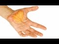 I have a Huge Blister!!! FX Series