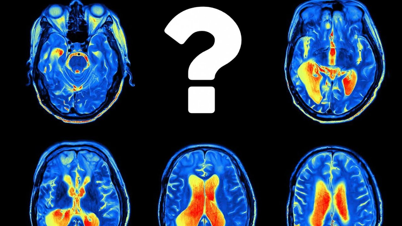 داروهای ضد افسردگی با مغزمون چیکار میکنن ؟ 💊