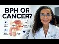 Is Your Enlarged Prostate Actually Dangerous? Dr Lamia Gabal Explains Causes Of Enlarged Prostate