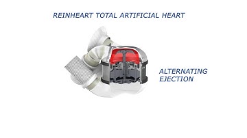 ReinHeart Animation (English)