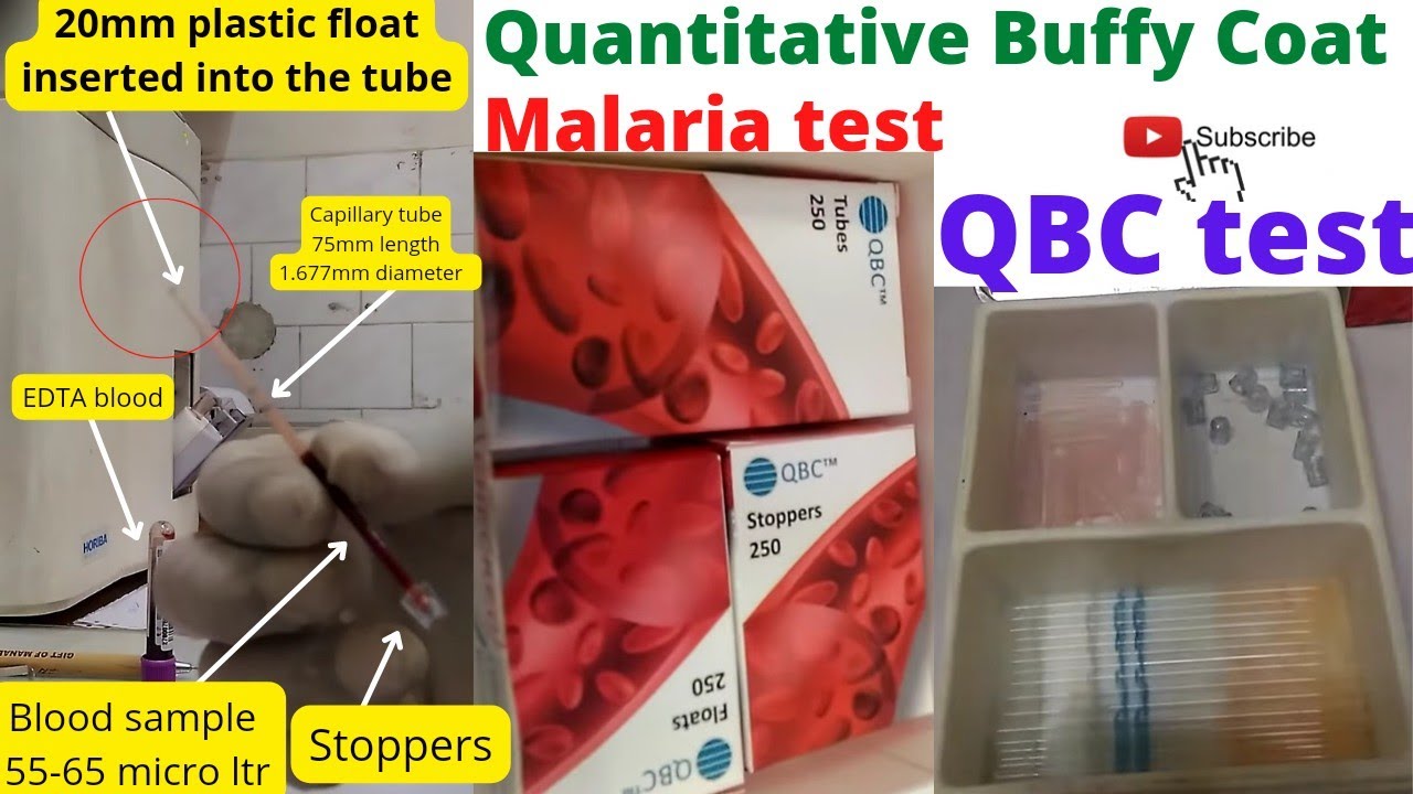 MP QBC Test by gold standard Method Quantitative Buffy Coat