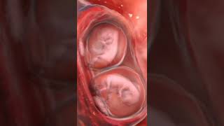 Twins fetus baby