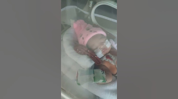 perjuangan anak mama saat pertama lahir #baby #bayilucu #bayigemes #babygirl #newborn #cutebaby