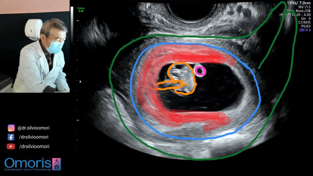 Беременность 8 недель!!
