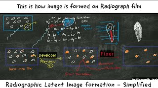 Radiographic Latent Image formation |ASPIRE MDS | NEET | AIIMS| MDS