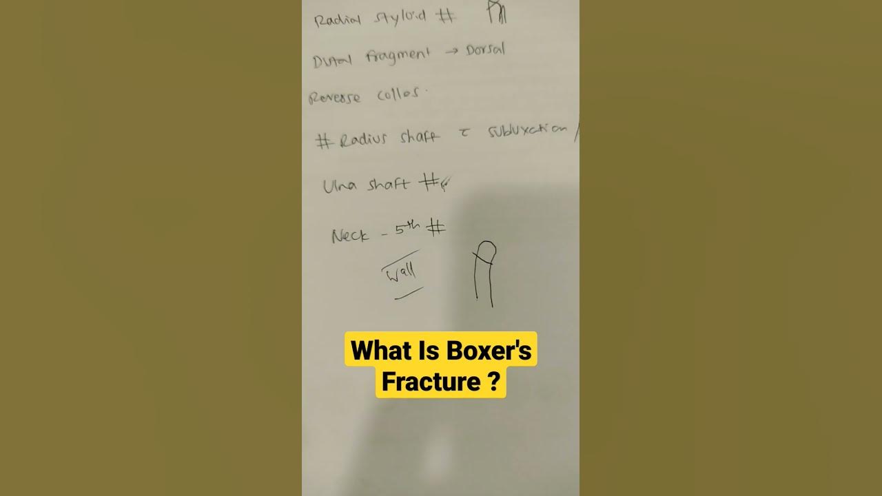 what-is-boxer-s-fracture-dr-sai-chandra-orthopaedic-surgeon-in