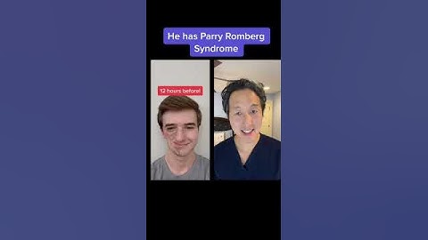 Plastic Surgeon Reacts to Jaw Surgery Countdown! #shorts #jawsurgery