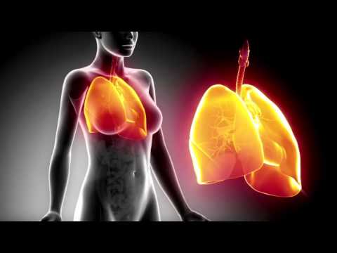 Ενημερωτικό βίντεο για την Πνευμονία