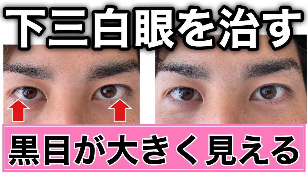 黒目が大きくなる 下三白眼を治して優しい目つきにする方法 Youtube