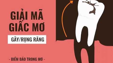Mơ thấy rụng răng không chảy máu? Là điềm báo tốt hay xấu?
