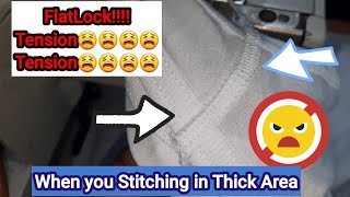 Piece Moving problem In Flat Lock /Feed dog Problem /Pressure Foot