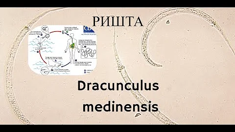 Ришта (Dracunculus medinensis) - Морфология, Жизненный Цикл, Диагностика, Лечение, Профилактика