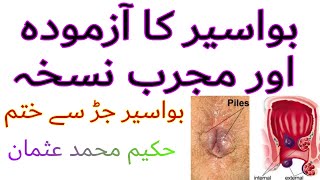 Bawaseer ka mukamal Ilaaj in urdu/Hindi/Piles treatment without Operation