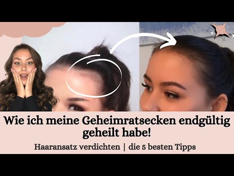 Video: 3 Wege, um Ihren Haaransatz nachwachsen zu lassen