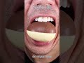 The Most Satisfying Chocolate and Candy ASMR Compilation 🍫🍬 #DoctorTristanPeh #Chocolate #Candy