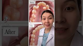 Гранд дент стоматология в Астане