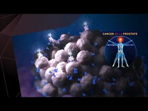 Vidéo: Comment le lutétium est-il utilisé dans le traitement du cancer ?