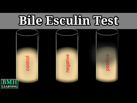 Bile Esculin Test | Bile Esculin Test For Enterococcus Identification | Bile Esculin Agar |