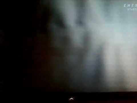 This is Us - Baby Jack is Blind - YouTube