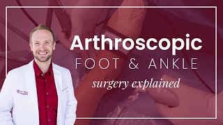 What is Arthroscopic Surgery?