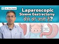 ✅Laparoscopic Sleeve Gastrectomy ✅Bariatric Surgery Step by Step Dr. Vikas Singhal Bariatric Surgeon