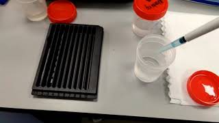 Food & Inhalation Allergy Panel Procedure Part 6 - Medical Laboratory Procedures | Tutorial