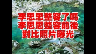 李思思整容了嗎李思思整容前後對比照片曝光 李思思整容了嗎李思思整容前後對比照片曝光