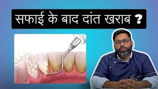 दांतों की सफाई के बाद क्या दांत खराब हो जाते हैं ? | Feeling tooth sensitivity after cleaning?