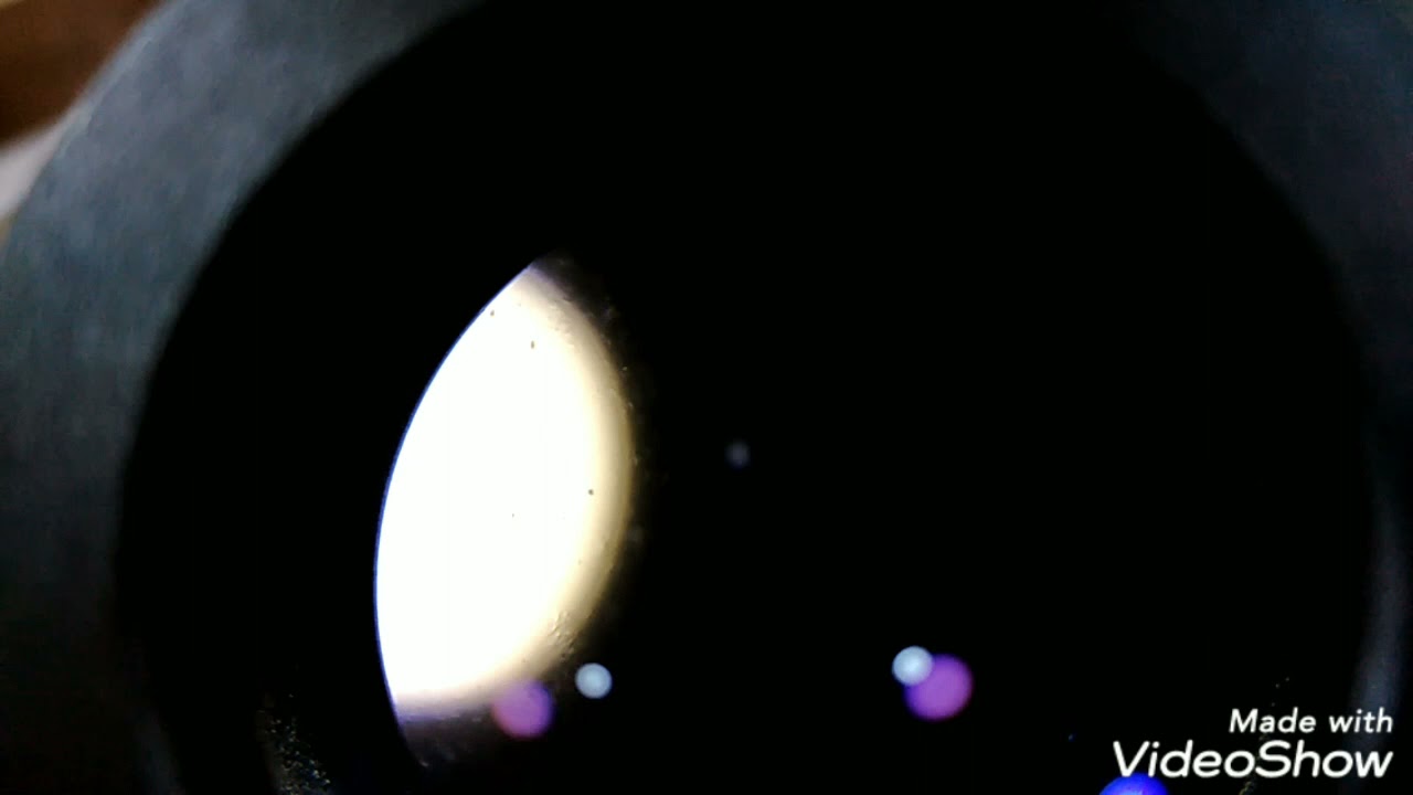 E. histolytica Trophozoites