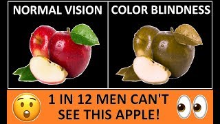 Types of Color Blindness | Color Vision Deficiency
