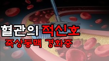 혈관건강의 적신호! 나도 모르게 걸리는 죽상동맥 경화증!