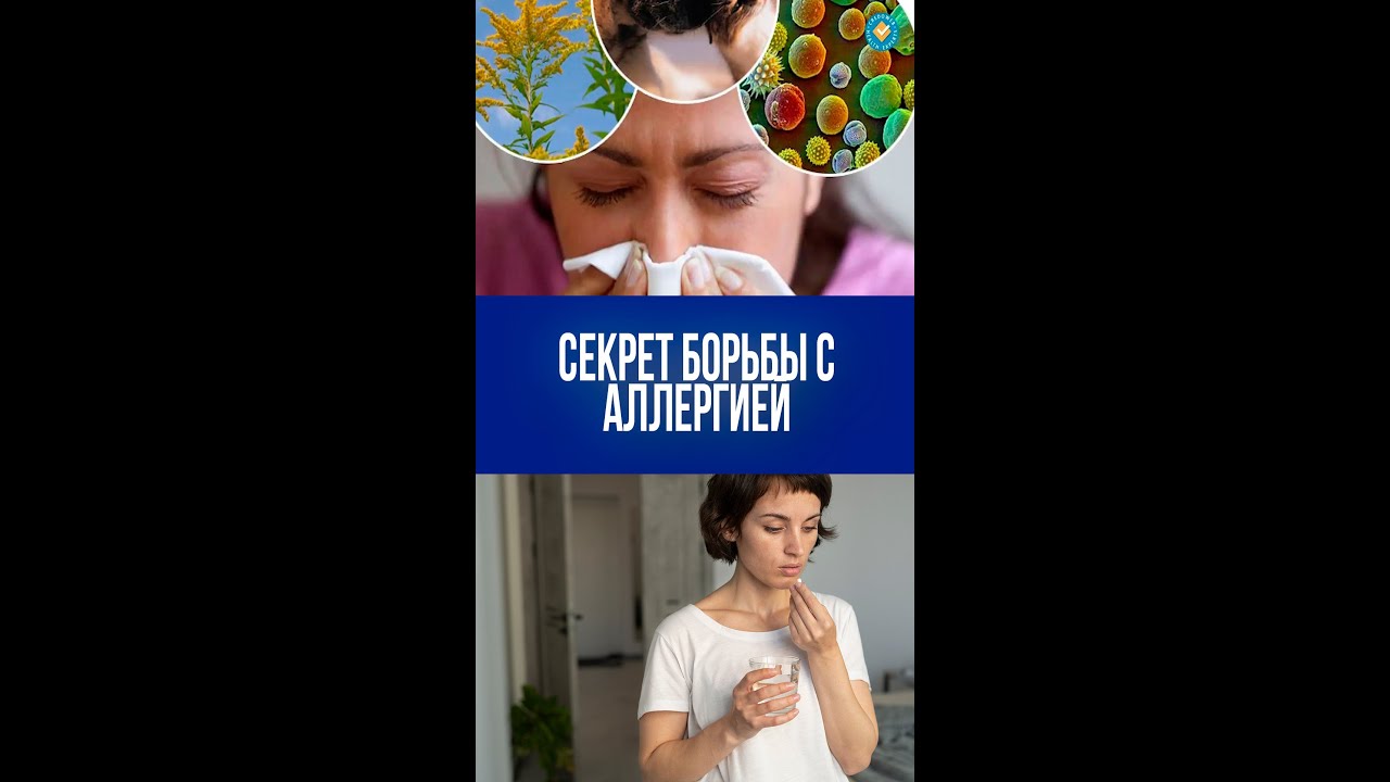 Секретная техника, как справиться с сезонной аллергией на пыльцу — уникальные советы иммунолога