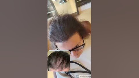 Scalp Micropigmentation at Ink & Ashberry