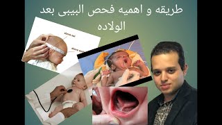 الطريقه الكامله و اهميه فحص البيبي بعد الولاده و حقنه فيتامين ك دكتور اسلام عزام