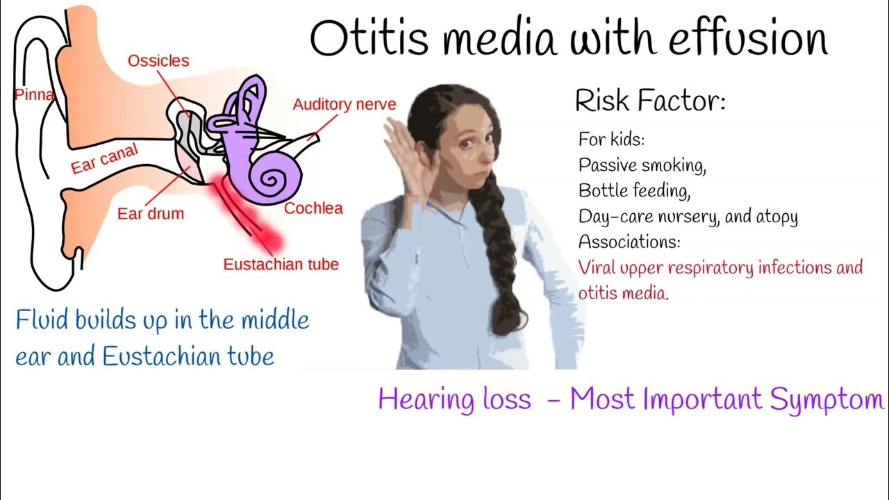 Otitis media with Effusion Most common cause of hearing loss in kids YouTube