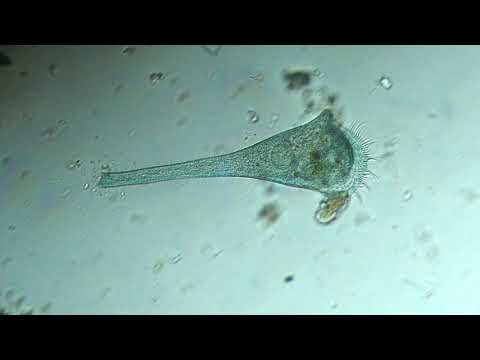 Stentor multiformis
