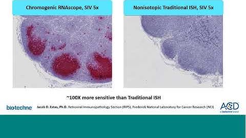 RNA in situ hybridization - the next generation of immunohistochemistry  20180619